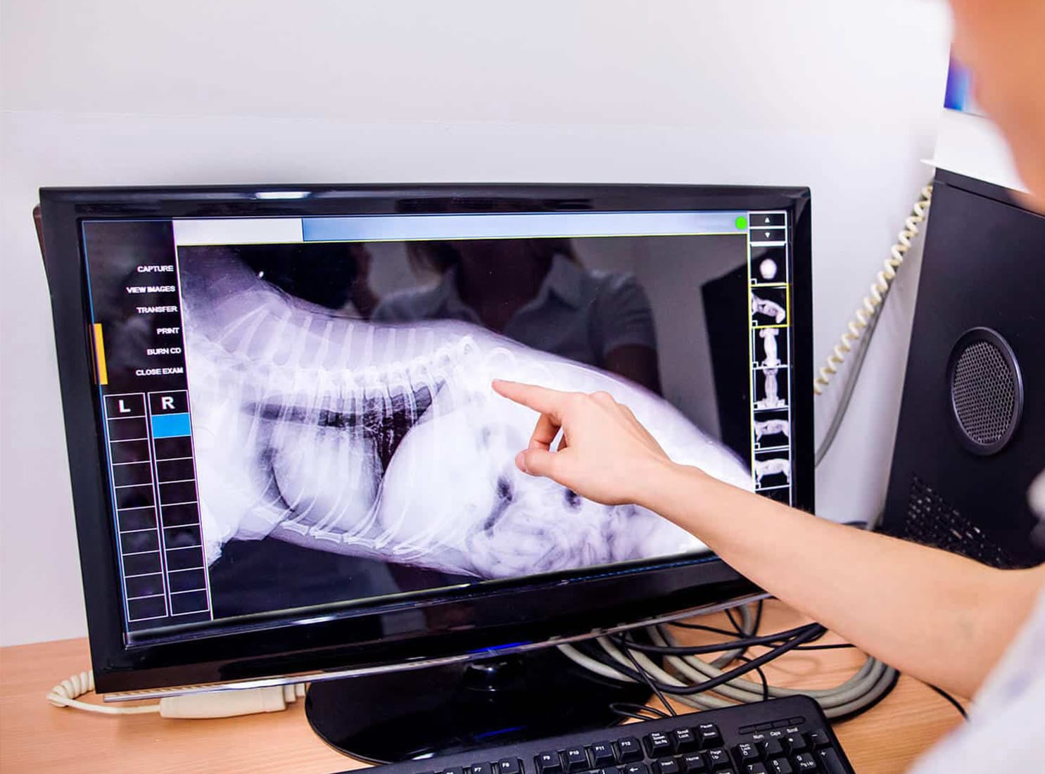 a medical professional examines an X-ray image on a computer screen